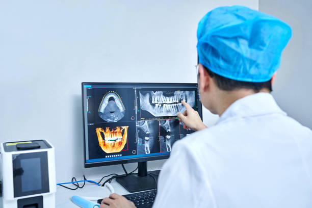 Best Emergency Tooth Extraction in Thedral City, CA