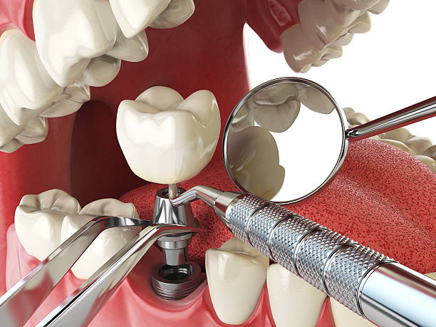 Best Emergency Dental Surgery in Thedral City, CA