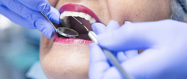 Best Emergency Tooth Extraction in Thedral City, CA